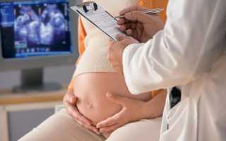 Уреаплазмоз и микоплазмоз при беременности